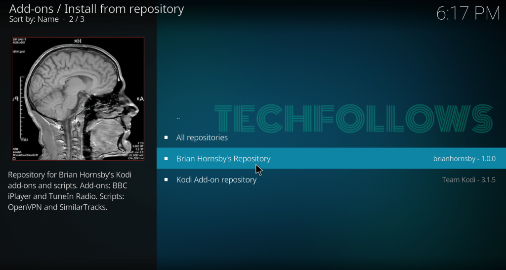 TuneIn Radio Kodi Addon   Installation Guide with Pictures - 79