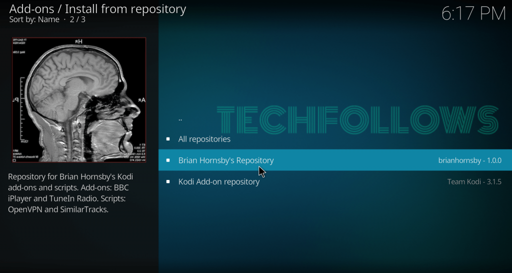 select the Brain Hornsby's repository to get TuneIn Radio Kodi Addon