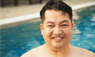 how to remove double chin